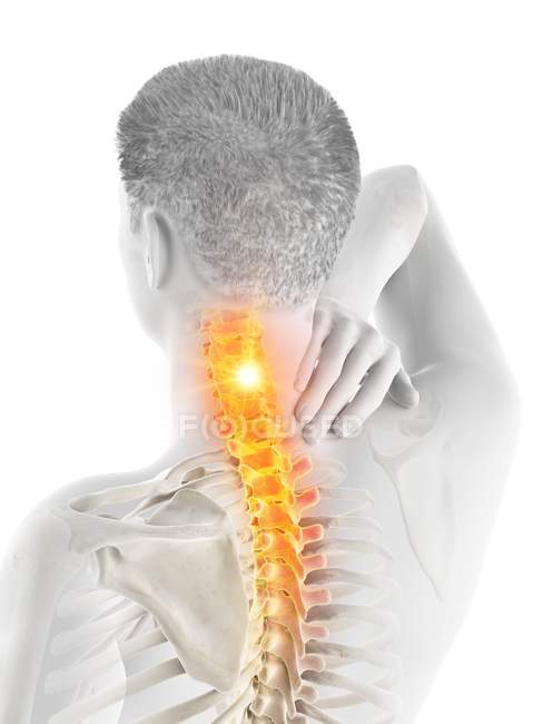 Corpo maschile astratto con dolore al collo visibile, illustrazione digitale . — Foto stock