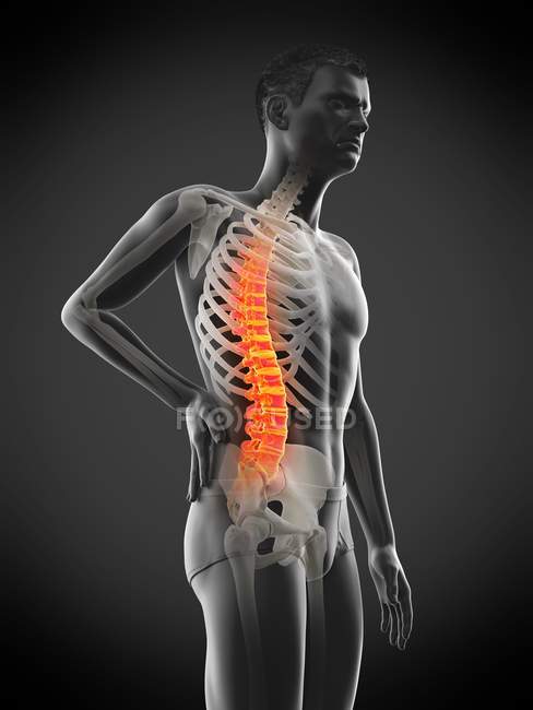 Вид збоку чоловічого тіла з болем у спині на чорному фоні, Концептуальна ілюстрація. — стокове фото