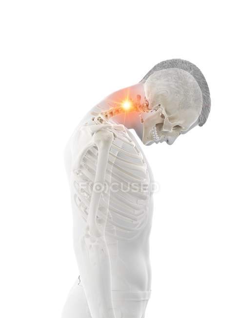 Abstract male silhouette with neck pain, conceptual illustration. — Stock Photo