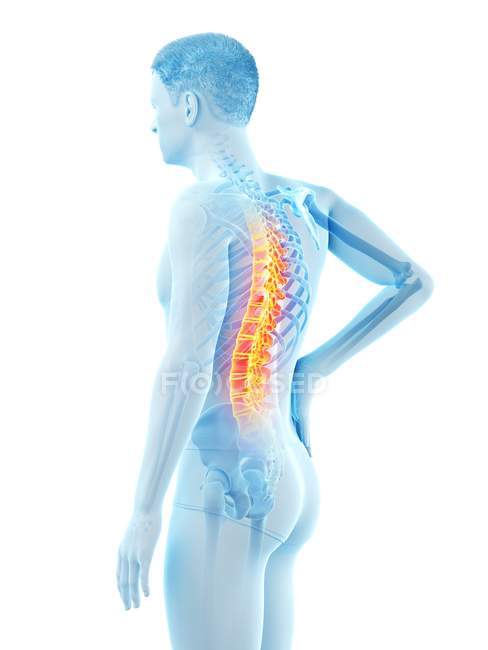 Seitenansicht des männlichen Körpers mit Rückenschmerzen auf weißem Hintergrund, konzeptionelle Illustration. — Stockfoto