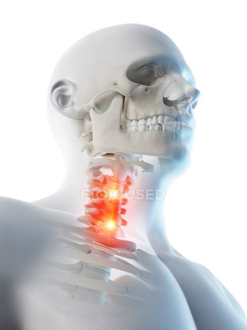 Abstrakter männlicher Körper mit detaillierten Nackenschmerzen, konzeptionelle digitale Illustration. — Stockfoto