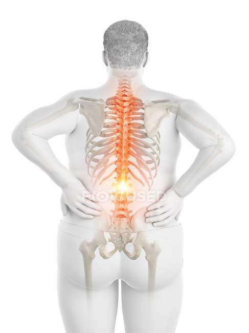 Obese male body with back pain, digital illustration. — Stock Photo