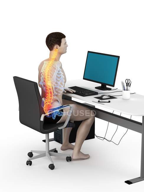 Silhueta de funcionário de escritório sentado na mesa com dor nas costas, ilustração conceitual . — Fotografia de Stock