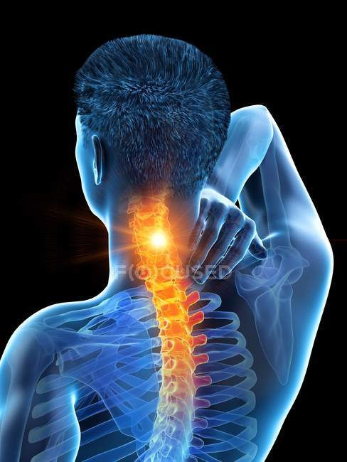 Abstrakter männlicher Körper mit sichtbaren Nackenschmerzen, digitale Illustration. — Stockfoto