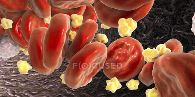 Ilustración digital de las bolas de lípidos de colesterol en los vasos sanguíneos . - foto de stock