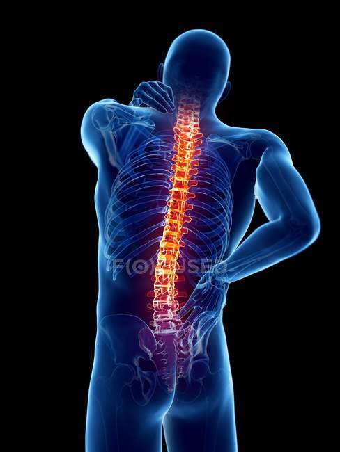 Cuerpo masculino con dolor de espalda sobre fondo negro, ilustración digital . - foto de stock