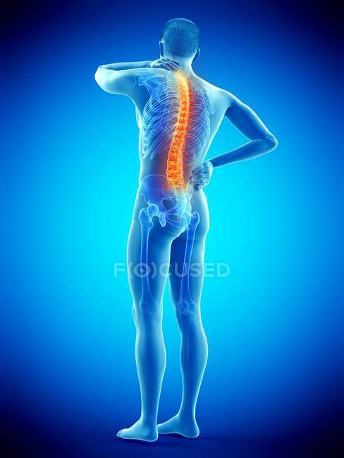 Corpo masculino com dor nas costas na visão traseira, ilustração conceitual . — Fotografia de Stock