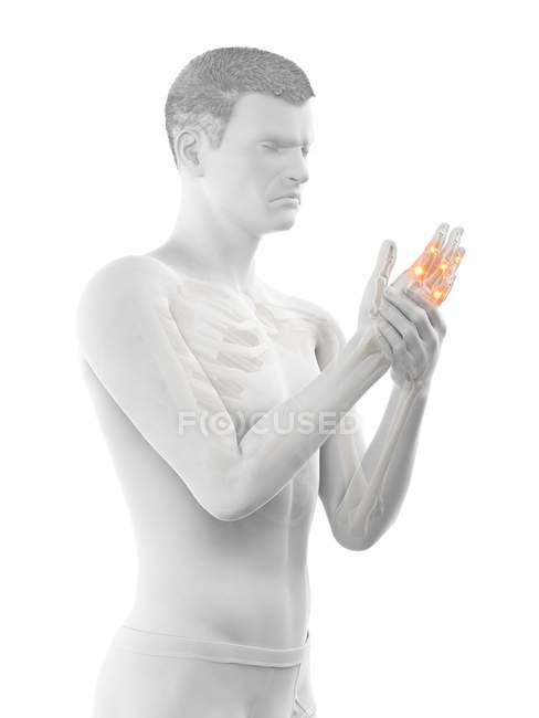 Abstract man having finger pain, conceptual illustration. — Stock Photo