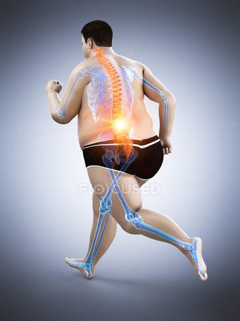 Obese male runner body with back pain, conceptual illustration. — Stock Photo