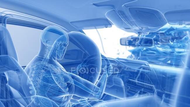 Illustration par rayons X du risque de blessure lors d'un accident de voiture frontal, illustration numérique
. — Photo de stock