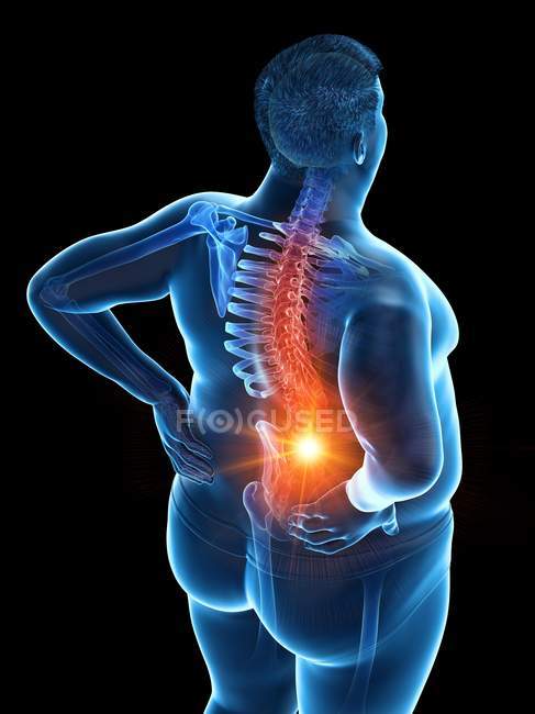 Corpo masculino obeso com dor nas costas em visão de alto ângulo, ilustração digital . — Fotografia de Stock