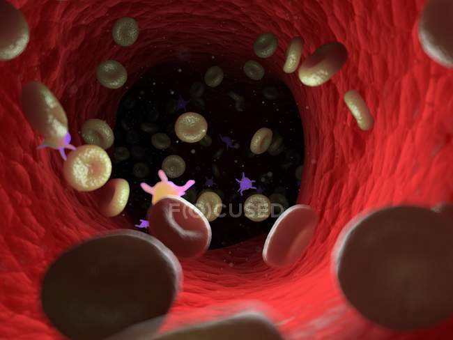 Болезненные клетки крови с бактериями, компьютерная иллюстрация . — стоковое фото