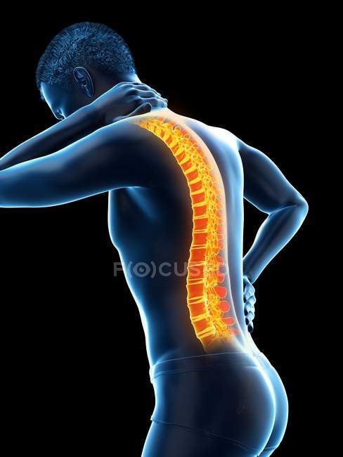 Bending male silhouette with back pain, conceptual illustration. — Stock Photo
