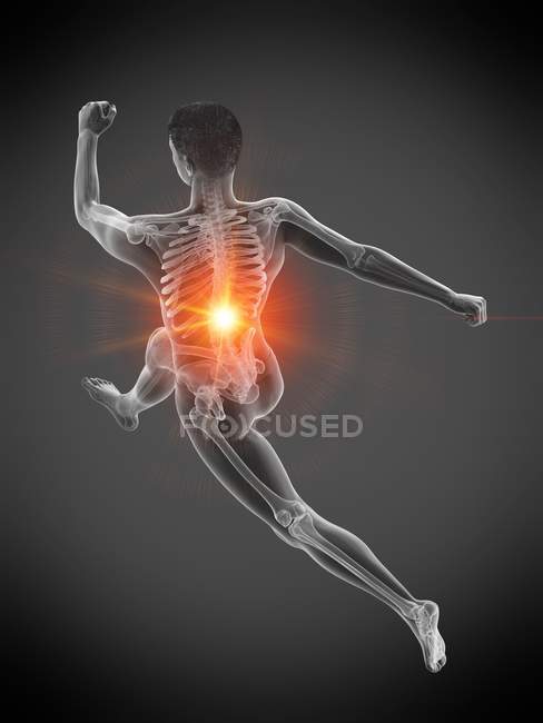 Silhueta de corredor masculino com dor nas costas em visão de alto ângulo, ilustração conceitual . — Fotografia de Stock