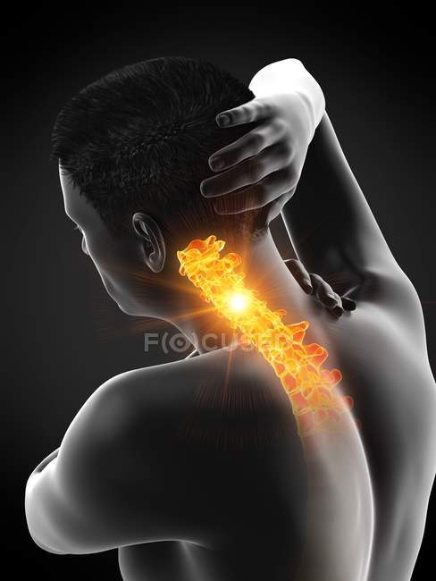 Corps masculin avec douleur visible au cou, illustration conceptuelle . — Photo de stock