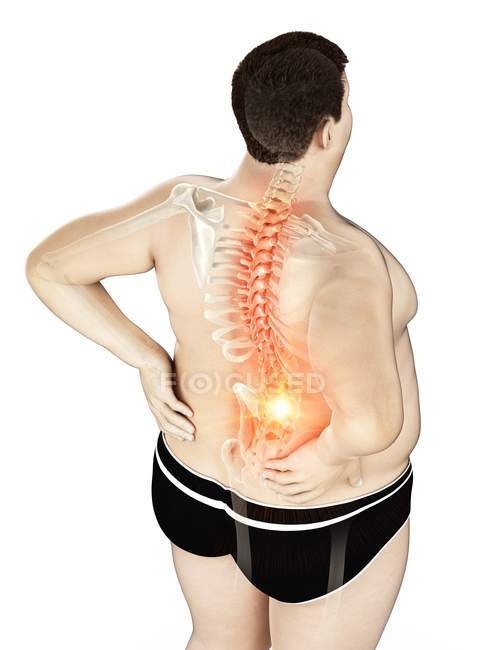 Cuerpo masculino obeso con dolor de espalda en vista de ángulo alto, ilustración digital . - foto de stock