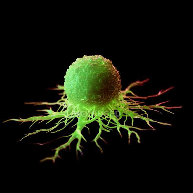 Abstract green colored cancer cell on black background, digital illustration. — Stock Photo