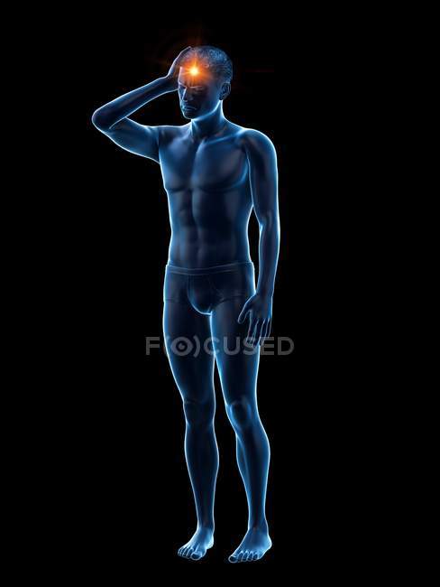 Hombre con dolor de cabeza, ilustración médica conceptual . - foto de stock