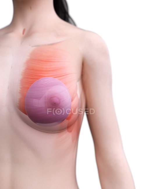 Anatomia dos implantes mamários no corpo feminino modelo 3d, ilustração digital . — Fotografia de Stock
