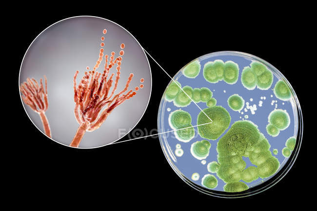 Kolonien von Penicillium-Pilzen, die auf Sabouraud-Dextrose-Agar angebaut werden und digitale Illustration der Pilzmorphologie. — Stockfoto