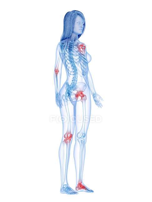 Articulations douloureuses dans le corps féminin, illustration conceptuelle . — Photo de stock