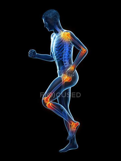 Силуэт мужского бега с болью в суставах, концептуальная иллюстрация . — стоковое фото