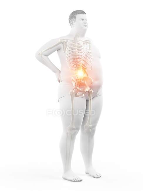 Obeso macho silhueta de comprimento total com dor nas costas, ilustração digital . — Fotografia de Stock