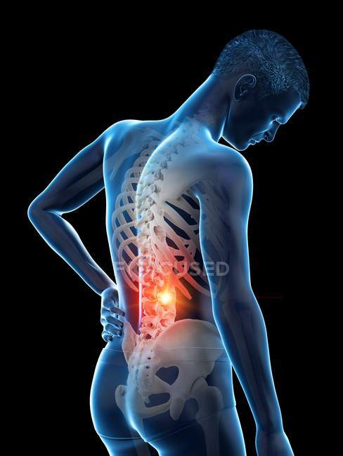 Male silhouette with back pain on black background, conceptual illustration. — Stock Photo