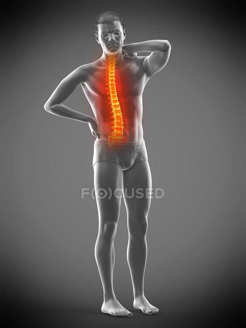 Corpo masculino com dor nas costas na visão traseira, ilustração conceitual . — Fotografia de Stock