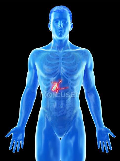 Cáncer de vesícula biliar en el modelo 3d del cuerpo masculino, ilustración por computadora . - foto de stock