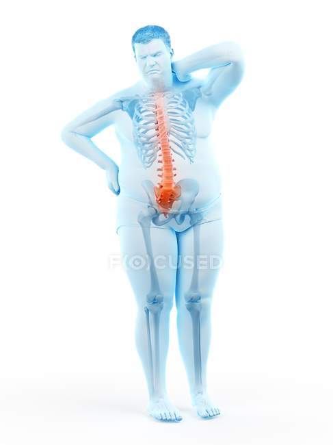 Forma maschile obesa a figura intera con mal di schiena, illustrazione digitale . — Foto stock