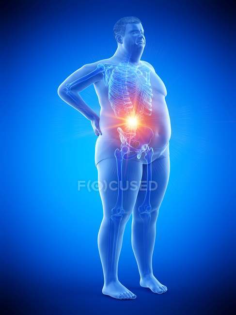Силуэт мужского ожирения с болями в спине, цифровая иллюстрация . — стоковое фото