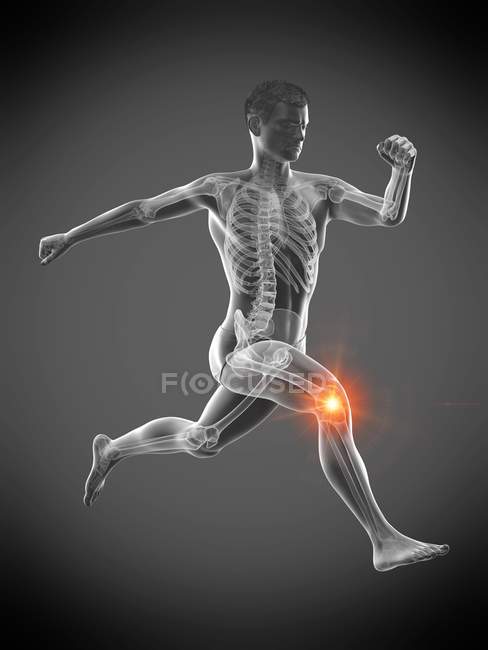 Силует бігуна з болем у коліні, цифрова ілюстрація . — стокове фото