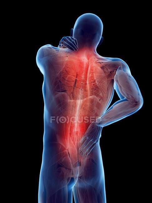 Männlicher Körper mit Rückenschmerzen auf schwarzem Hintergrund, digitale Illustration. — Stockfoto