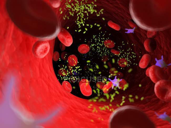 Bakterien inmitten von Blutzellen in Blutgefäßen, digitale Illustration. — Stockfoto