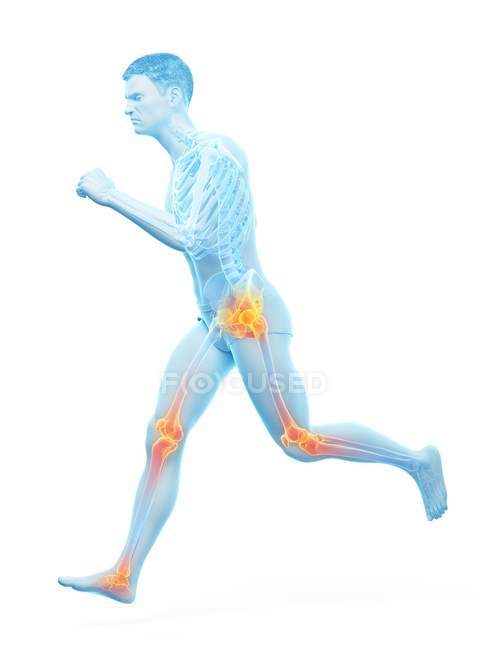 Hombre corriendo con puntos de dolor articular, ilustración conceptual
. - foto de stock
