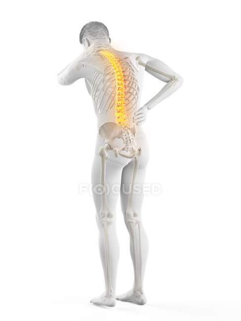 Задній вигляд чоловічого тіла в повній довжині з болем у спині, Концептуальна ілюстрація. — стокове фото