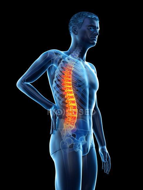 Vista lateral del cuerpo masculino con dolor de espalda sobre fondo negro, ilustración conceptual . - foto de stock
