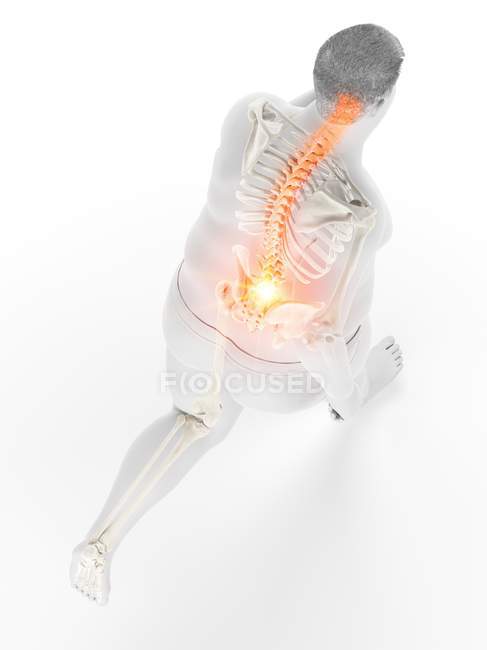 Vista de ángulo alto en corredor con sobrepeso con dolor de espalda, ilustración digital . - foto de stock