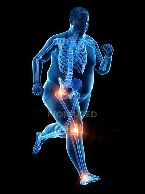 Silhouette of running obese man with joint pain, computer illustration. — Stock Photo