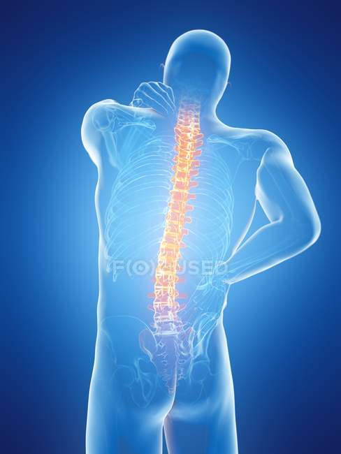 Cuerpo masculino con dolor de espalda sobre fondo azul, ilustración digital . - foto de stock
