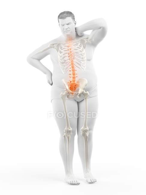 Obese male full length silhouette with back pain, digital illustration. — Stock Photo