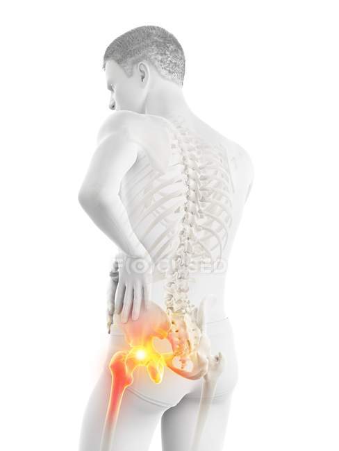Silhueta masculina abstrata com dor visível no quadril, ilustração digital . — Fotografia de Stock