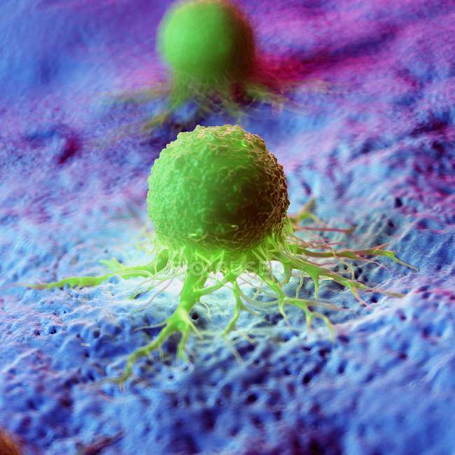 Células cancerosas de color verde abstracto en el tejido, ilustración digital . - foto de stock