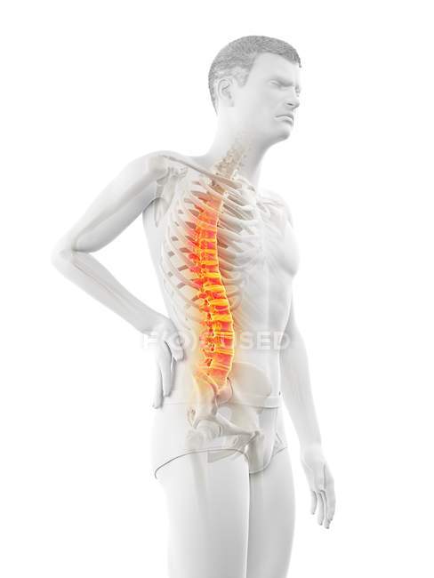 Side view of male body with back pain on white background, conceptual illustration. — Stock Photo