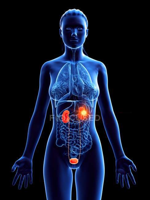 Silhueta de mulher com câncer de rim, ilustração digital conceitual . — Fotografia de Stock