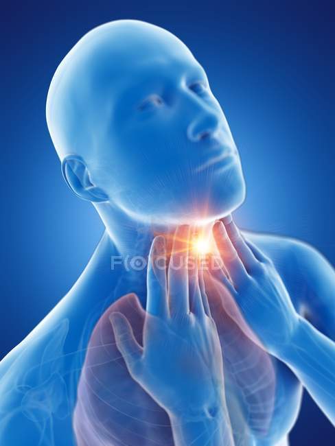 Corpo maschile astratto con mal di gola su sfondo blu, illustrazione digitale concettuale . — Foto stock
