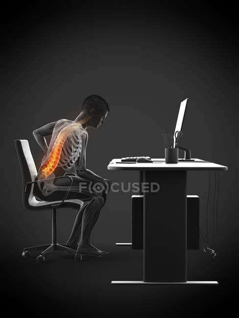 Vista lateral del trabajador de oficina con dolor de espalda debido a sentarse en el escritorio, ilustración conceptual . - foto de stock