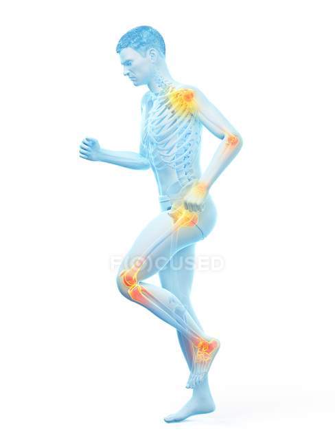 Silueta del corredor masculino con dolor en las articulaciones, ilustración conceptual
. - foto de stock