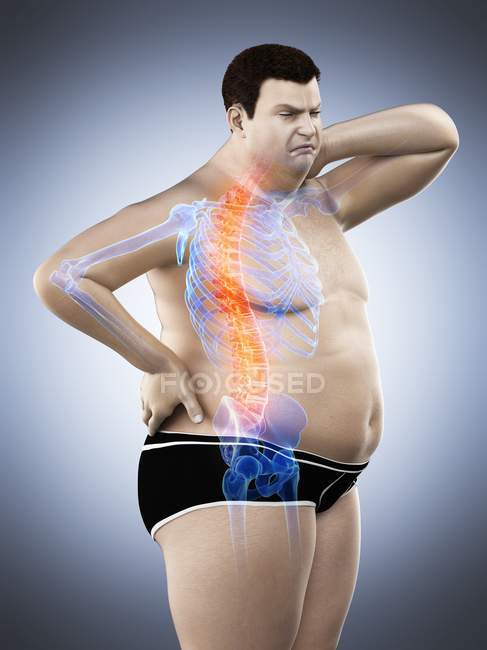 Corpo maschile obeso con mal di schiena, illustrazione digitale . — Foto stock